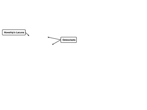 Osteoclasts