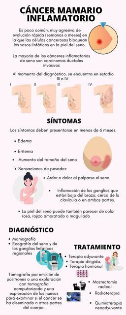 Cáncer de mama inflamatorio Aleshita medstudent uDocz