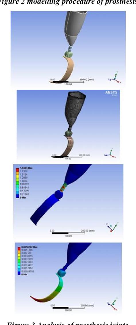 Figure 3 From DESIGN ANALYSIS AND FABRICATION OF BIOMEDICAL IMPLANT