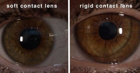 Struggling To Remove Contact Lenses Easy Techniques To Get Them Out