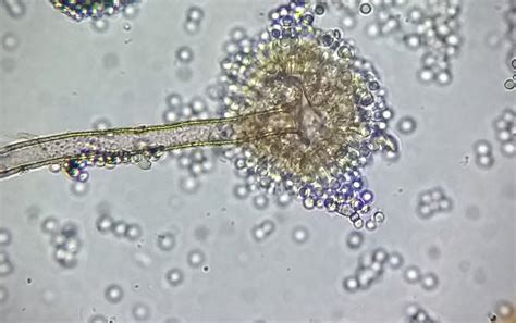 Aspergillus Flavus