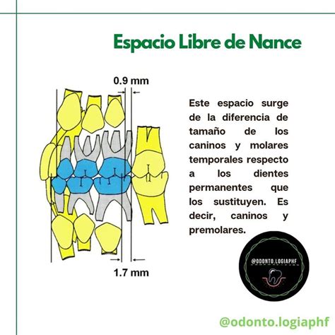 Espacio Libre De Nance Odontología Dientes Permanentes Odontopediatria