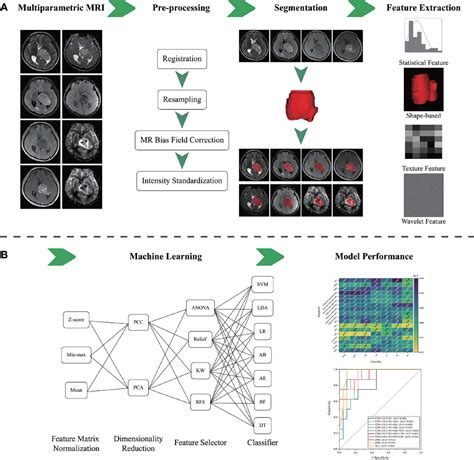 Figure 1 From Multiparametric Mri Based Radiomics Model For Predicting