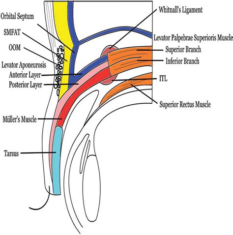 Figure 1 From Levator Palpebrae Superioris An Anatomical Update Semantic Scholar