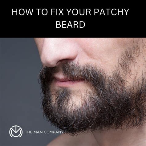 How To Fix Your Patchy Beard Quadis Foodies And Goodies