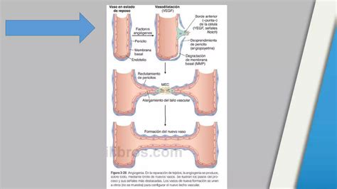 Inflamacion Granulomatosa Patolog A Ppt