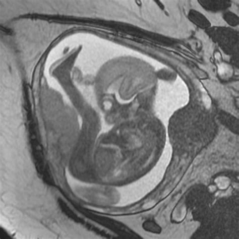 Baby Mri Flickr Photo Sharing