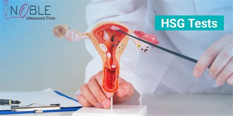 What Is A Hysterosalpingogram Hsg Test By Noble Ultrasound Jan