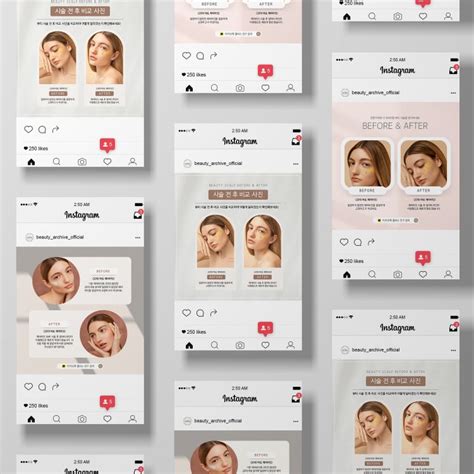 비포 애프터 인스타그램 피드 디자인 15장 세트