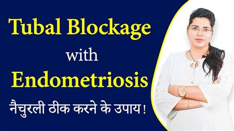 Endometriosis With Fallopian Tube Blockage Natural