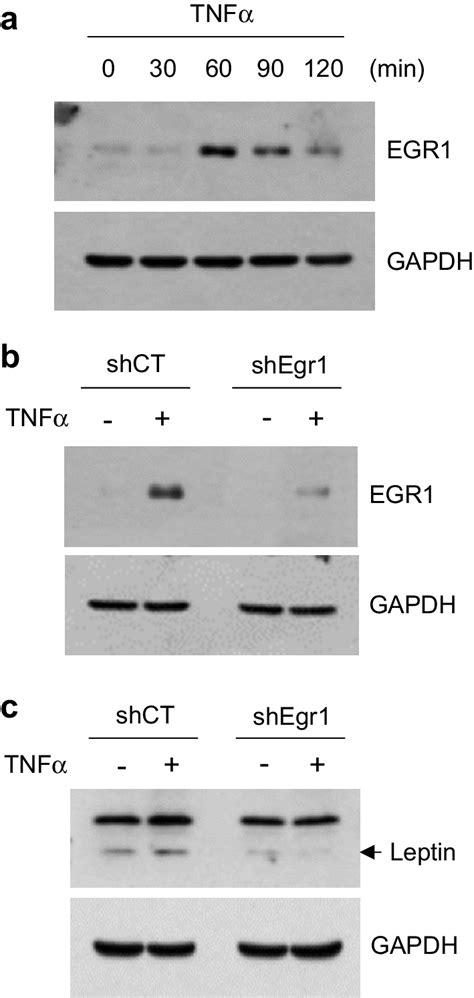 Effect of EGR1 silencing on TNF α induced leptin expression a MCF 7