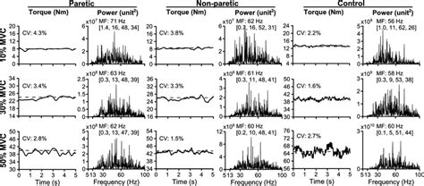 Examples Of Torque And Emg Power Spectrum Profiles In The Rectus