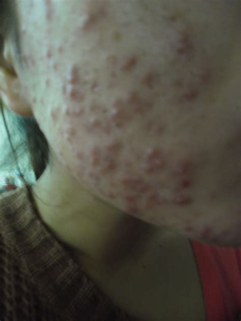 how to have clear skin on face 9