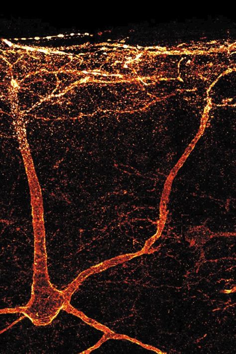 Internalization Of The Nk1 Receptor In A Neuron Within The Spinal