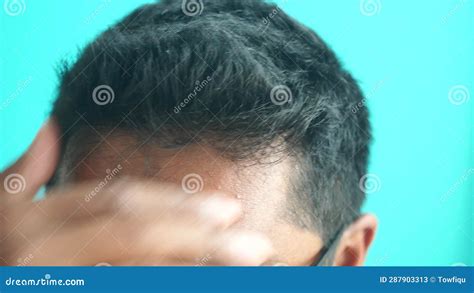 Hair Loss Concept With Man Checking His Hair Stock Video Video Of