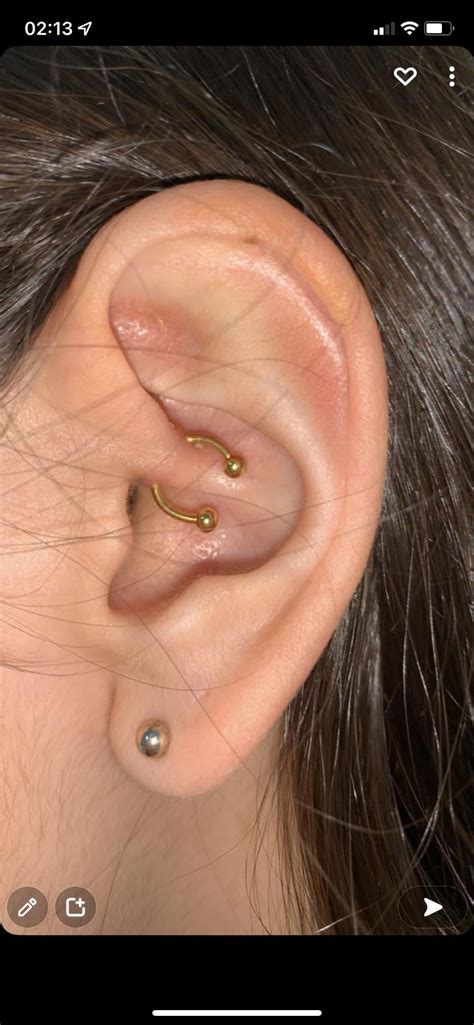 Advice For Bump On Daith Piercing Legitpiercing