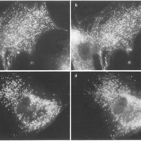 Distribution Of Lysosomes In Human Fibroblasts Normal A And B Or