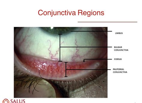 Conjunctiva Flashcards Quizlet