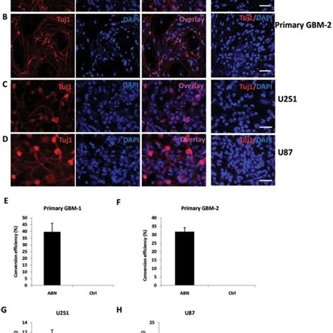 The Abn Neuronal Transcription Factors Inhibit Glioma Cell