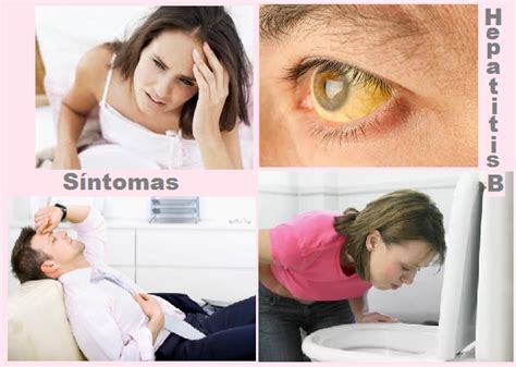 Hepatitis B S Ntomas