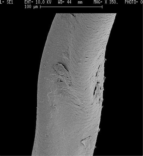 Scanning electron microscopy of the hair shaft from a patient affected ...