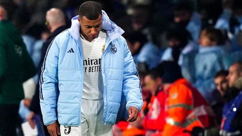 OFFICIEL GROSSE BLESSURE ET FIN DE SAISON POUR MBAPPÉ LE REAL EST