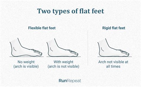 Arch Support For Runners What How And Why In Depth Guide Runrepeat