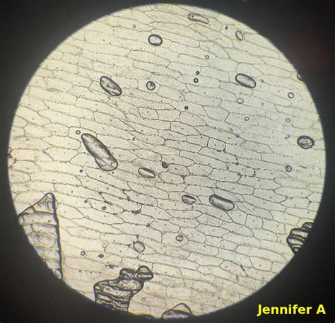 Onion Cells Stained With Iodine Under Microscope