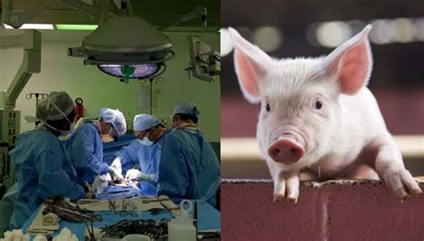 Man undergoes successful transplant using pig kidney