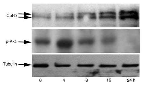 SciELO Brasil E3 Ubiquitin Ligase Cbl B Potentiates The Apoptotic