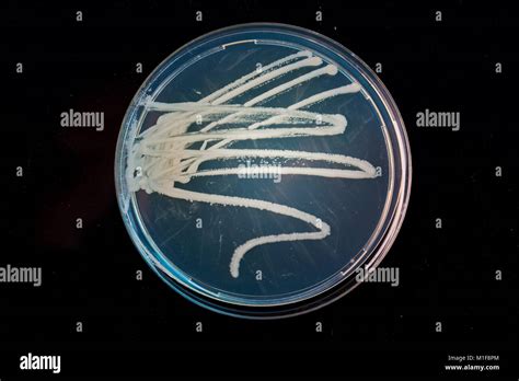 Pile Petri Dish With Growing Cultures Of Microorganisms In Doctor Hand