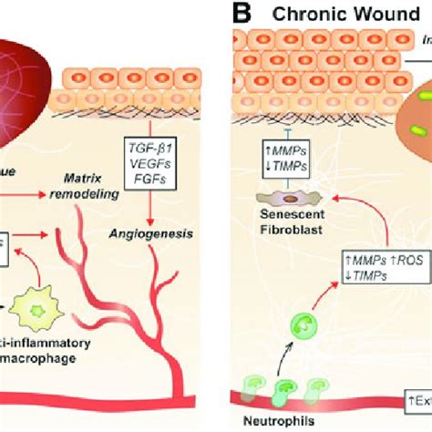 Overview Of The Immune Mechanisms In Acute And Chronic Wound Healing