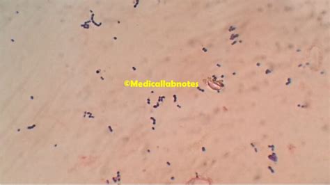 Streptococcus Pyogenes Introduction Morphology Pathogenicity