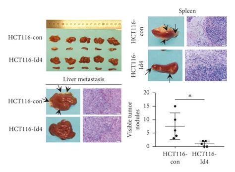 Id4 Regulated The Migration Invasion And Metastatic Potentials Of Crc