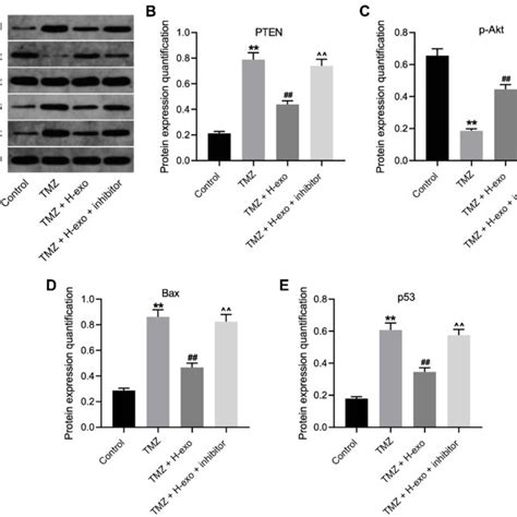 Exosomes Derived From Hypoxic Glioma Cells Reduced Tmz Sensitivity In