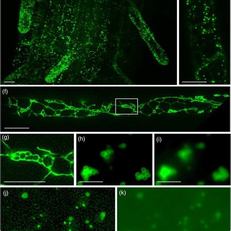 Survey Of Membrane‐bound Organelles In Vesicle Trafficking Pathways By