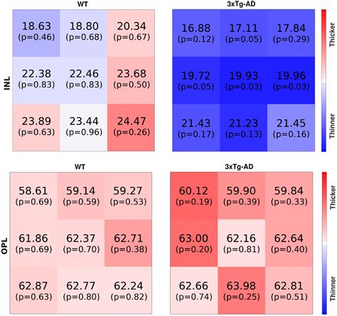 Longitudinal Normative Oct Retinal Thickness Data For Wild Type Mice And Characterization Of