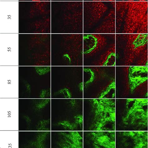 Structural Images Of Different Skin Layers Obtained Ex Vivo For Porcine