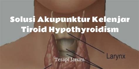 Solusi Akupunktur Kelenjar Tiroid Hypothyroidism Terapi Jarum