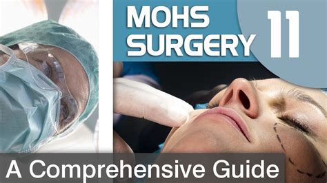 Preparing For Mohs Surgery Youtube