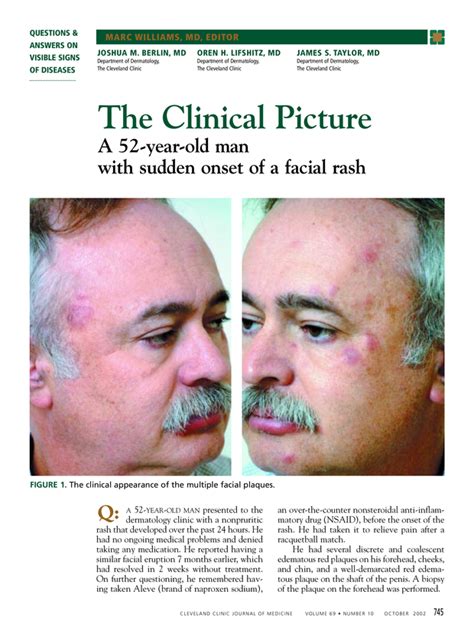 A 52 Year Old Man With Sudden Onset Of A Facial Rash Cleveland Clinic