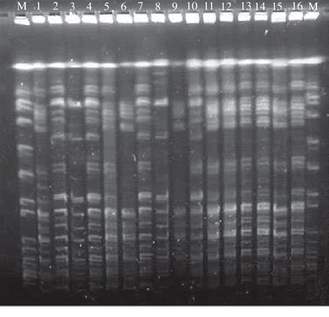 Pulsed Field Gel Electrophoresis Analysis Of 16 Methicillin Resistant