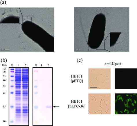 Expression Of Kpc Fimbriae On Recombinant E Coli A Transmission Download Scientific Diagram