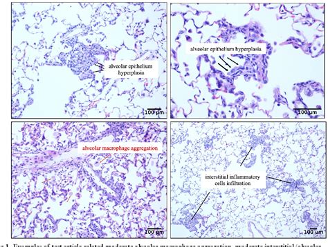 Figure 1 From Toxicological Evaluation Of Ultrapure And Potent Tannic