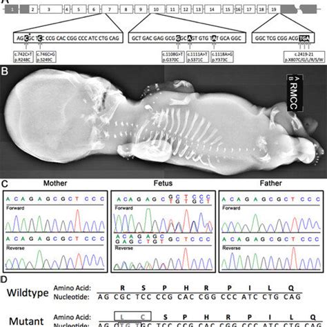 Pdf Identification Of A Novel Insertion Mutation In Fgfr That Causes