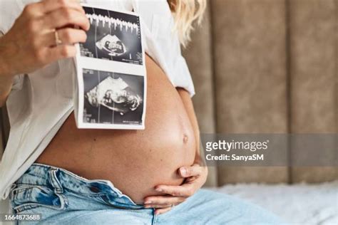 Human Embryo Twins Photos and Premium High Res Pictures - Getty Images