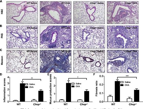 Figure 1 From Role Of C Ebp Homologous Protein And Endoplasmic