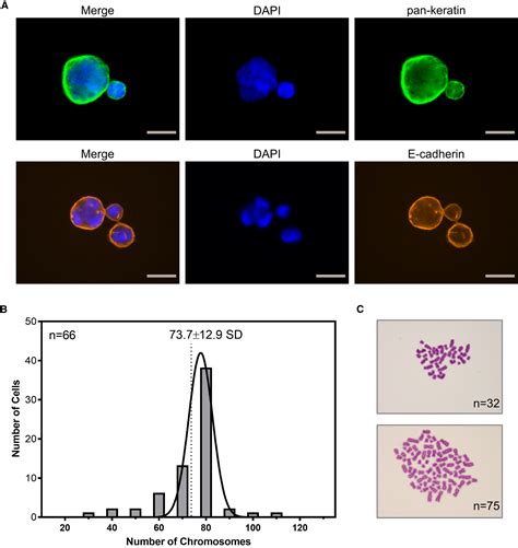 Characterization Of Circulating Breast Cancer Cells With Tumorigenic