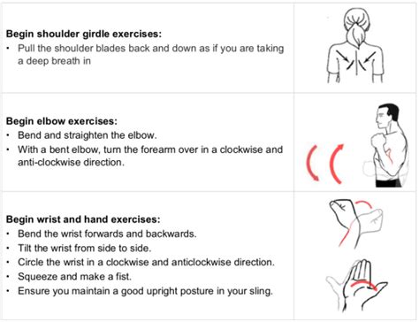 Clavicle Fracture Plate And Screw Rehab Adam Watson Orthopaedic Surgeon