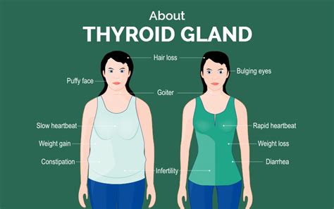 Basics Of Thyroid Disease: Types, Causes, Symptoms, Test,, 43% OFF